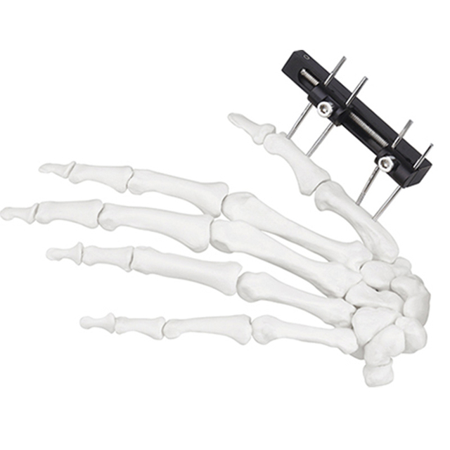 Jinlu Medical orthopedic bone fracture Mini fixator straight track type for metacarpal of the finger