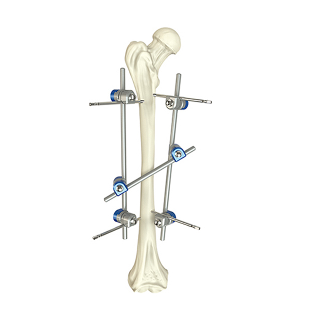  Hoffman DesignCombinational Femoral Shaft External Fixators for Orthopedic Fixation with CE