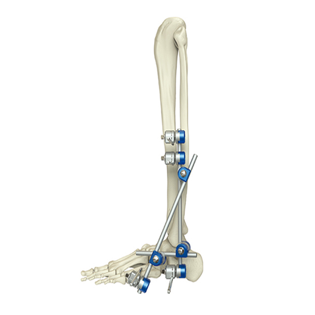 Hoffmam Design Combinational Ankle External Fixators for Orthopedic Fixation with CE