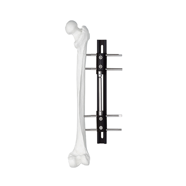 Orthofix Limb reconstruction External Fixators B type forOrthopedic fixation