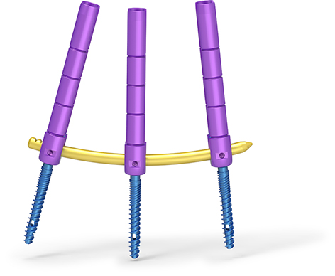 spinal products