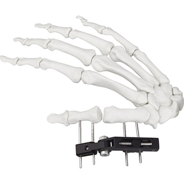 Jinlu Medical orthopedic bone fracture Mini fixator track vertical axis type for finger fracture