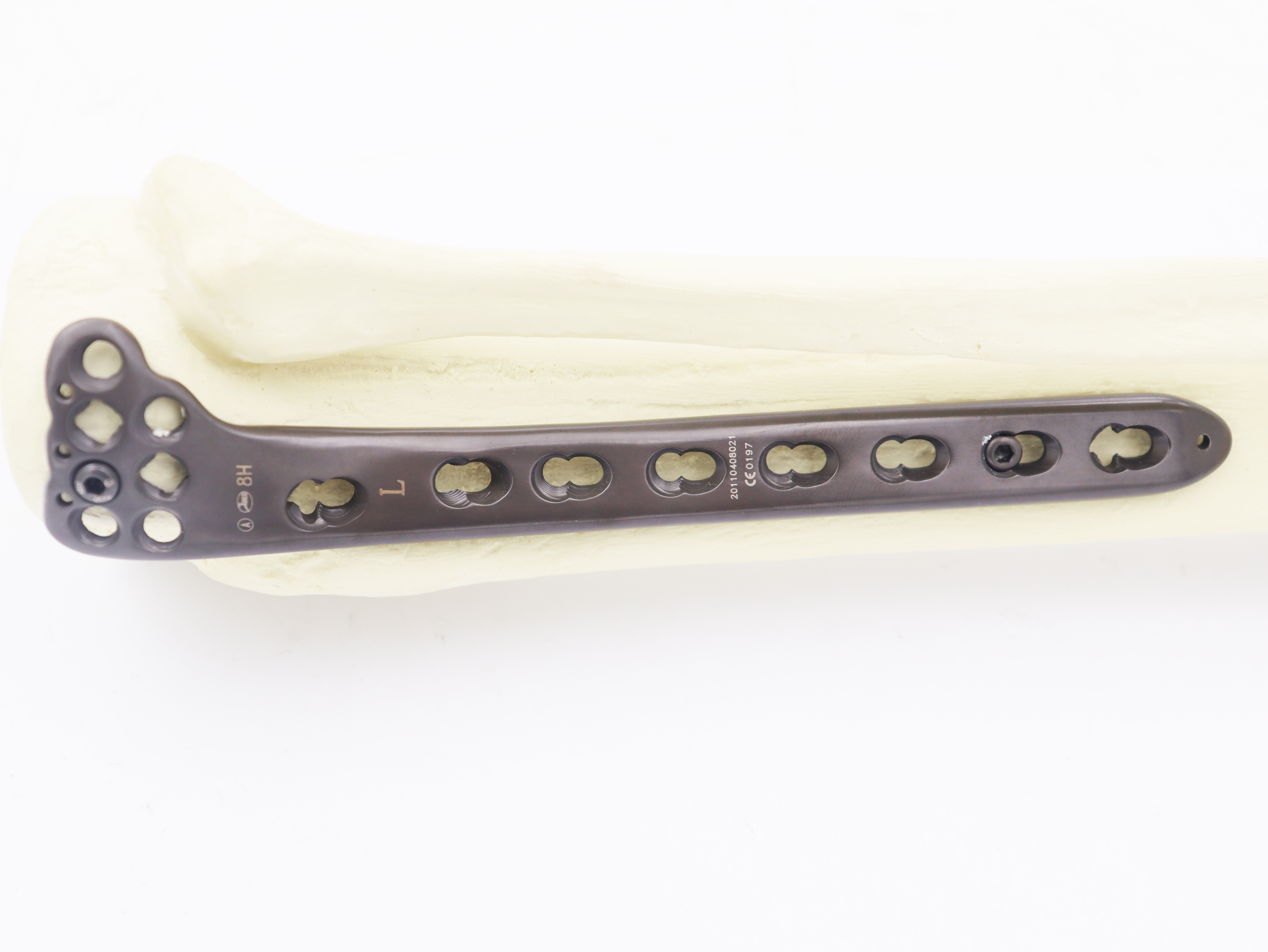 Orthopedic surgical Implants Proximal Tibial Lateral Locking plate for tibia Ⅲ(left/right)