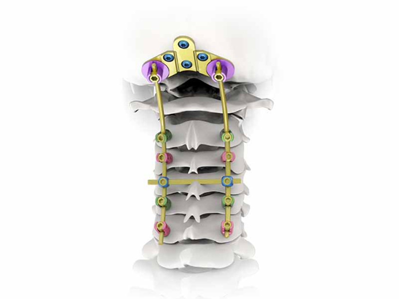 spinal products