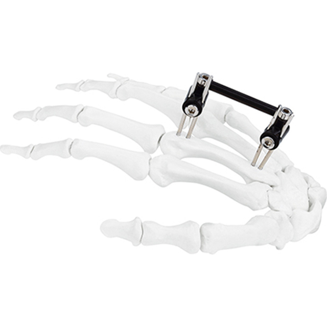 Jinlu Medical orthopedic Hand fixation Mini fixator combined type for finger bone fracture