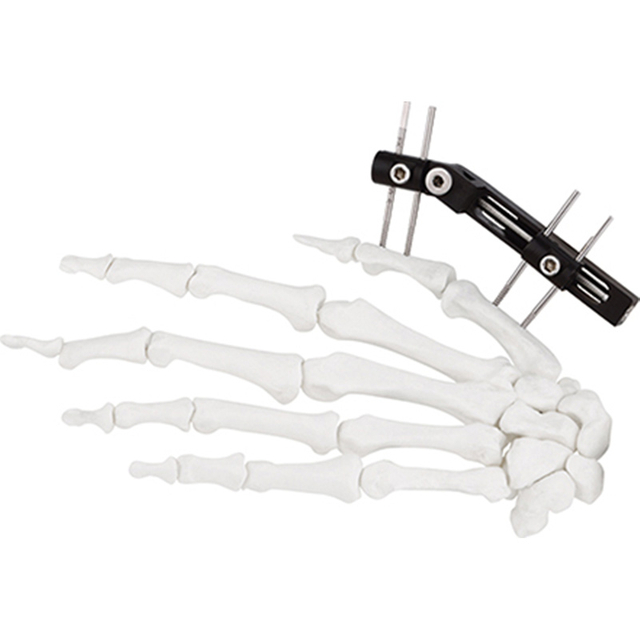 High quality orthopedic surgical implements fixation Hand Trauma Mini fixator track horizontal axis type for locking plate