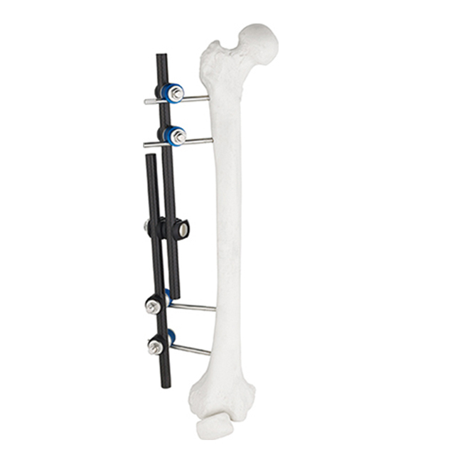 AO Design Combinational Straignt Type External Fixators for Femur& Tibia Orthopedic Fixation