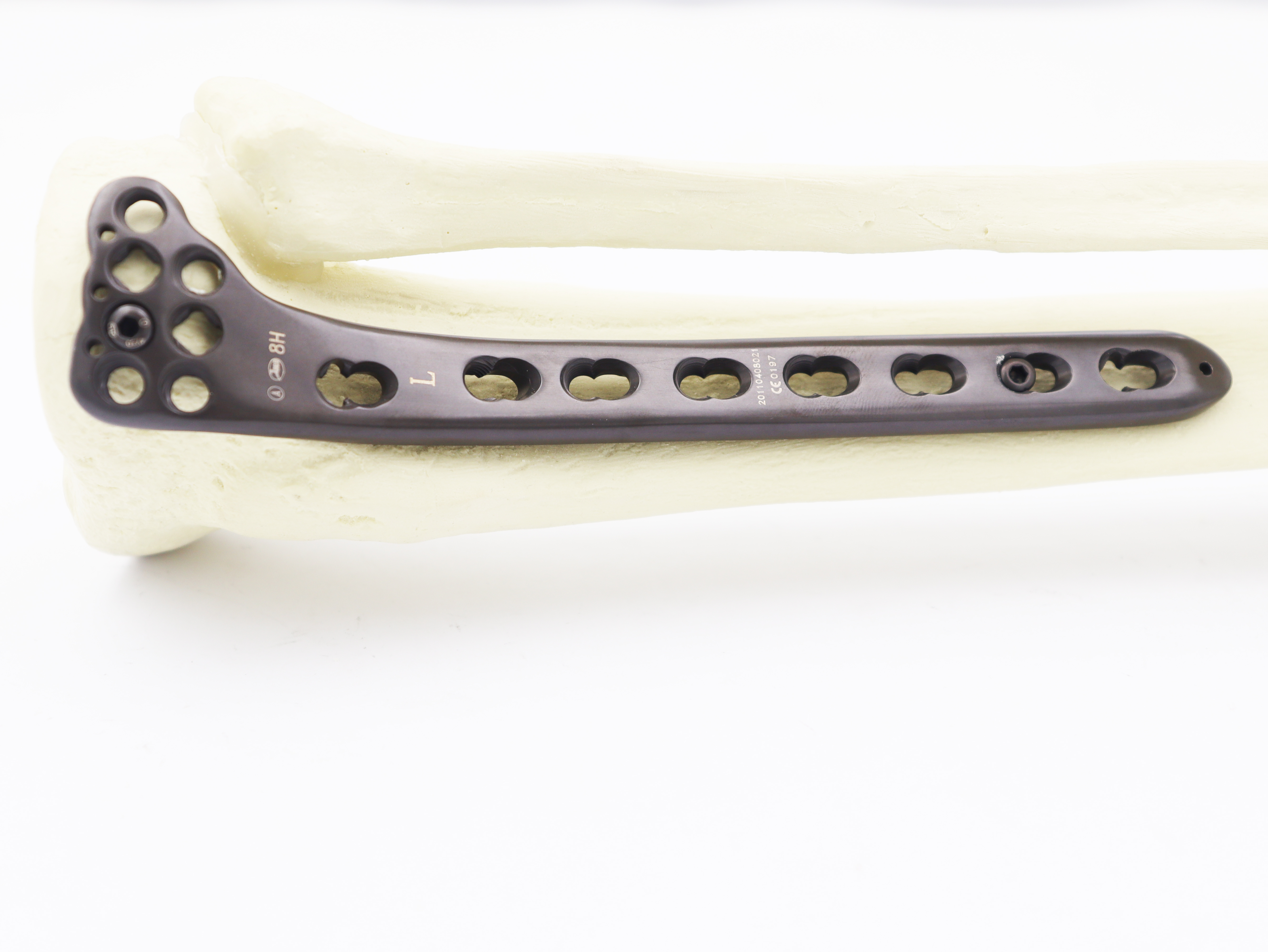 Orthopedic surgical Implants Proximal Tibial Lateral Locking plate for bone fracture