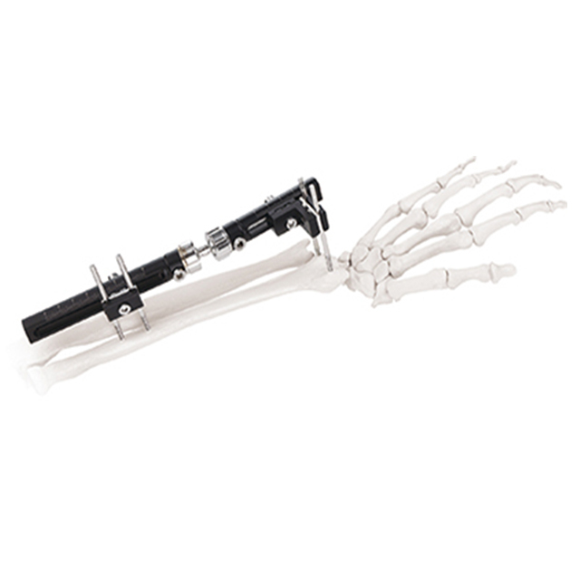 Orthofix Wrist External Fixators（L type） for Orthopedic Fixation