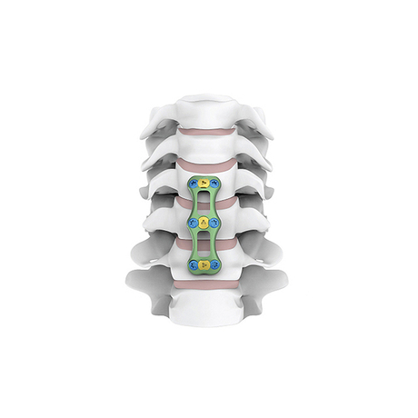 New Design Titanium Spinal Products Anterior Cervical Plate with CE