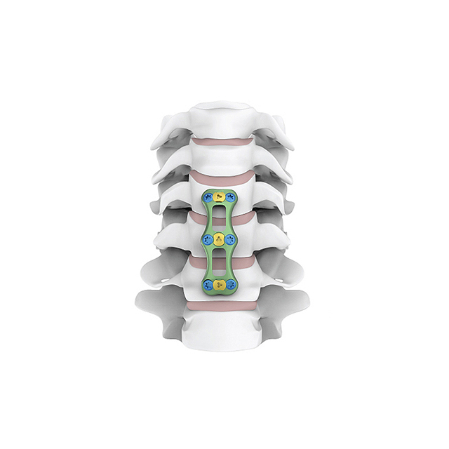 Manufacturer Titanium Spinal Products Anterior Cervical Plate with CE