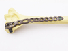 Orthopedic surgical Implants Distal Humeral Lateral Locking plate for humerus(left/right)