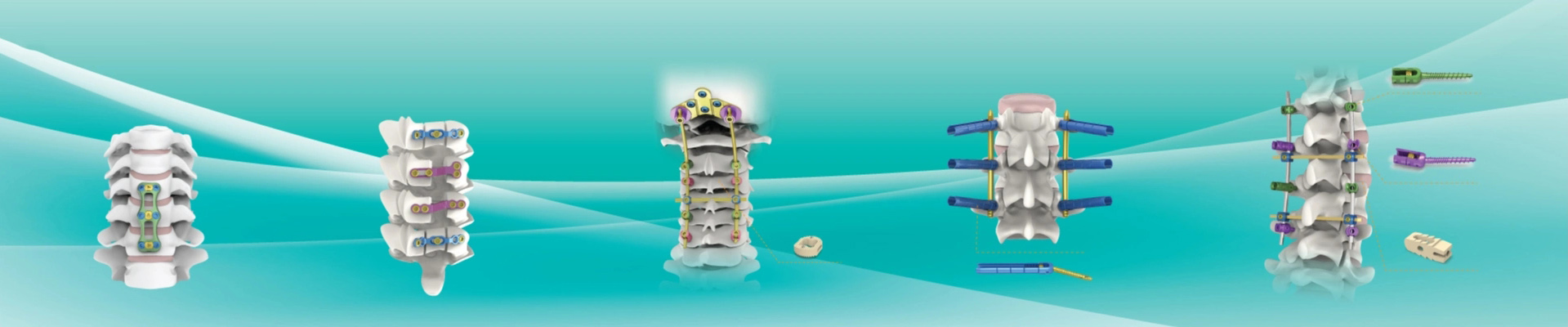 Orthopedic Implants