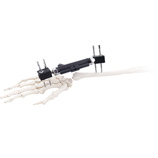 Orthofix Wrist External Fixators(Radiolucent Type) for Orthopedic Fixation 