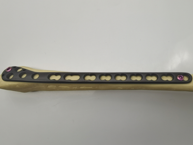 hot selling Orthopedic Implants Distal Fibular titanium locking plate using small head screw 