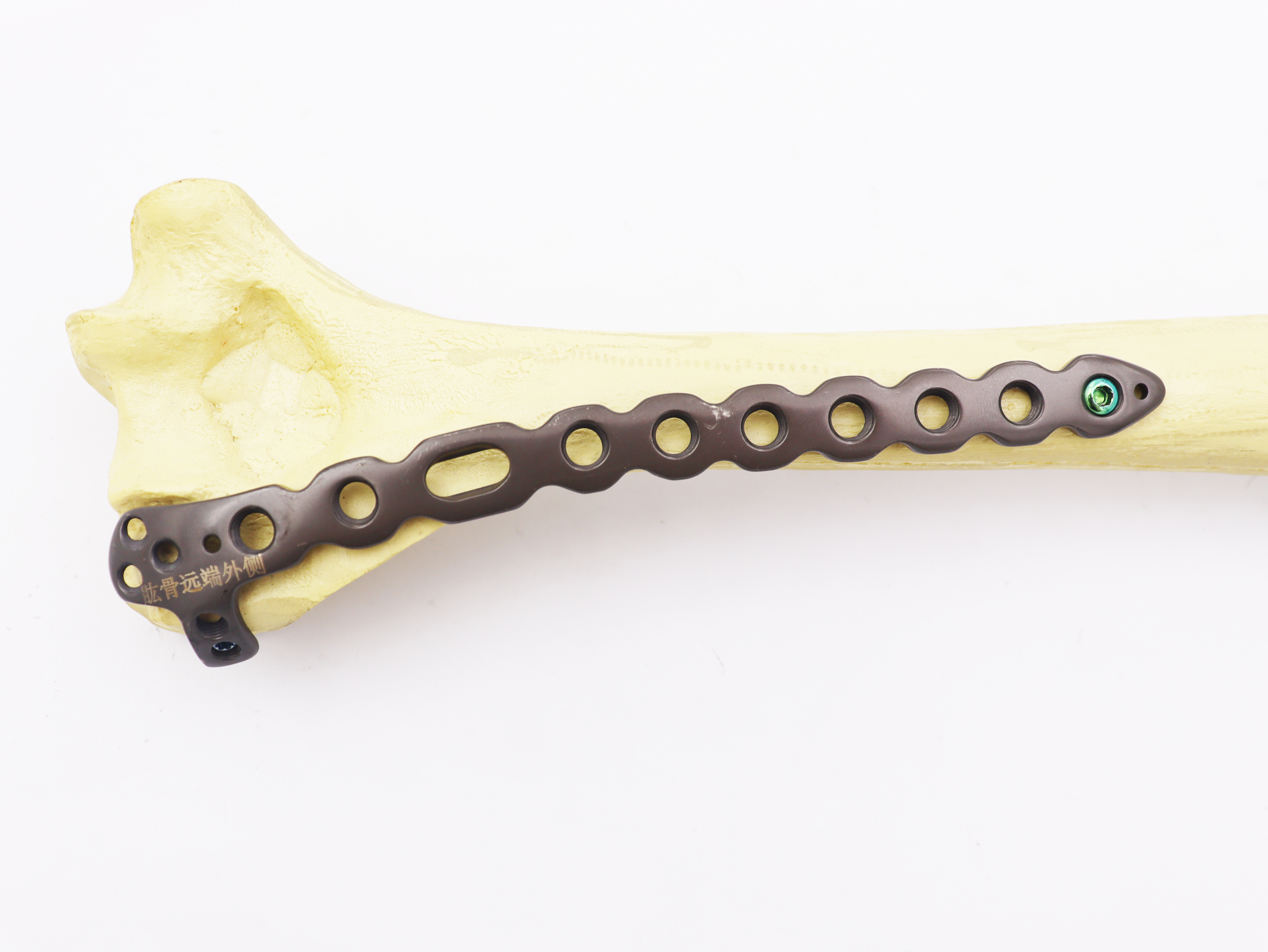 Orthopedic surgical Implants Distal Humeral Lateral Locking plate for humerus(left/right)