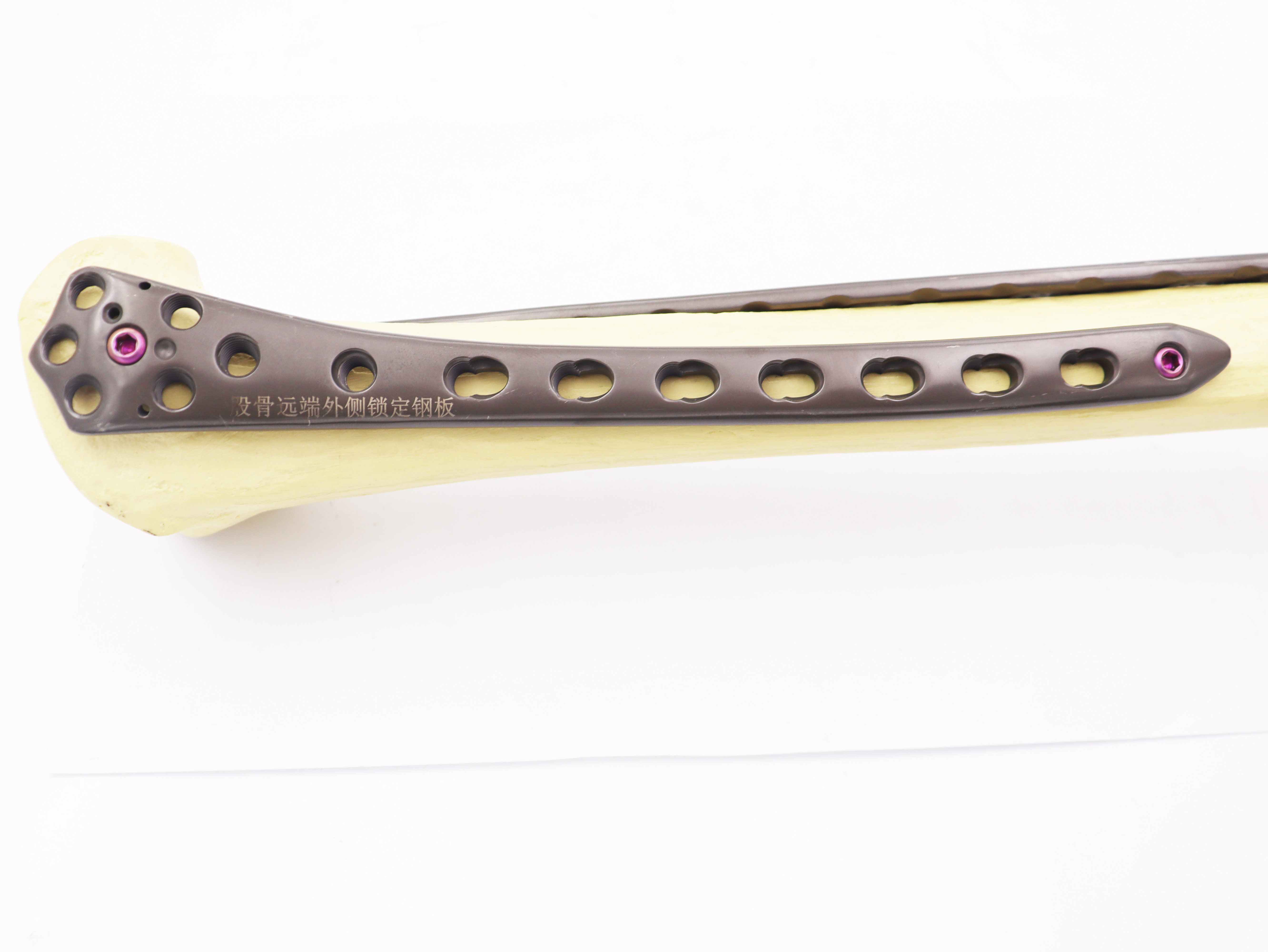 Jinlu Medical International materials Surgical Orthopedic Implants Distal Femur Lateral locking plate(left/right)