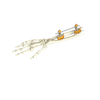  Hoffman Combinational External Forearm Fixators for Orthopedic Fixation with CE